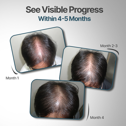 Hair Fact- Cyclical Nutrition Supplement Kit (M2O2)