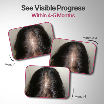 Hair Fact- Cyclical Nutrition Supplement Kit (F3O2)