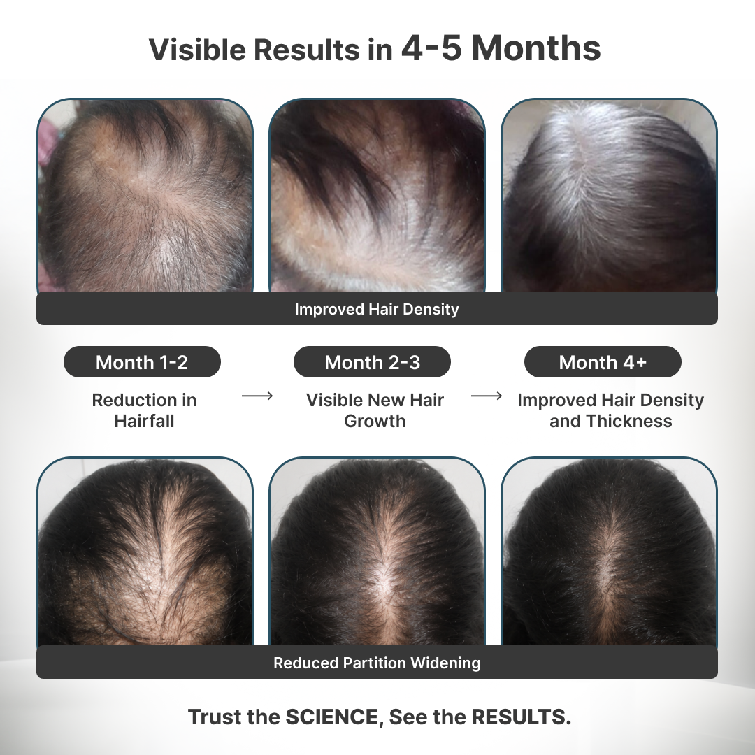 Women's Foundational Hair Kit