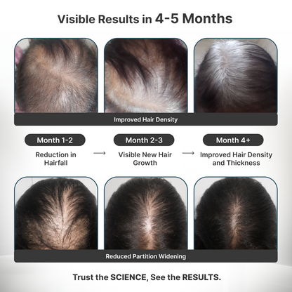 Women's Foundational Hair Kit