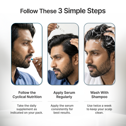 M102+ Minoxidil 5% + 0.1% Finasteride+ Biwash shampoo
