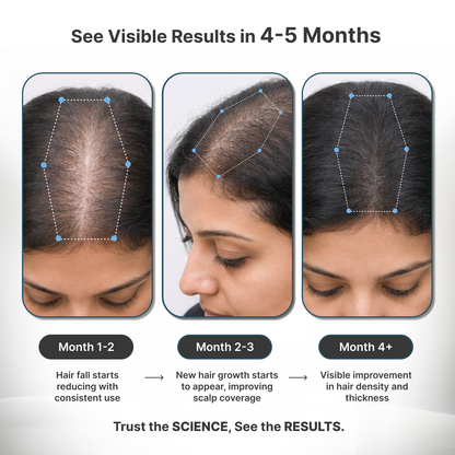 F102 + EMU Oil + Redensyl + Pro Biwash shampoo