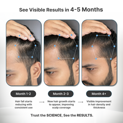 Telogen Effluvium Kit + Minoxidil 2% + Biwash shampoo